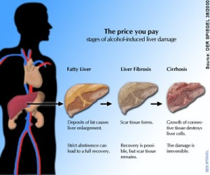 Alcohol affects many organs of the body and the liver is one of them. 